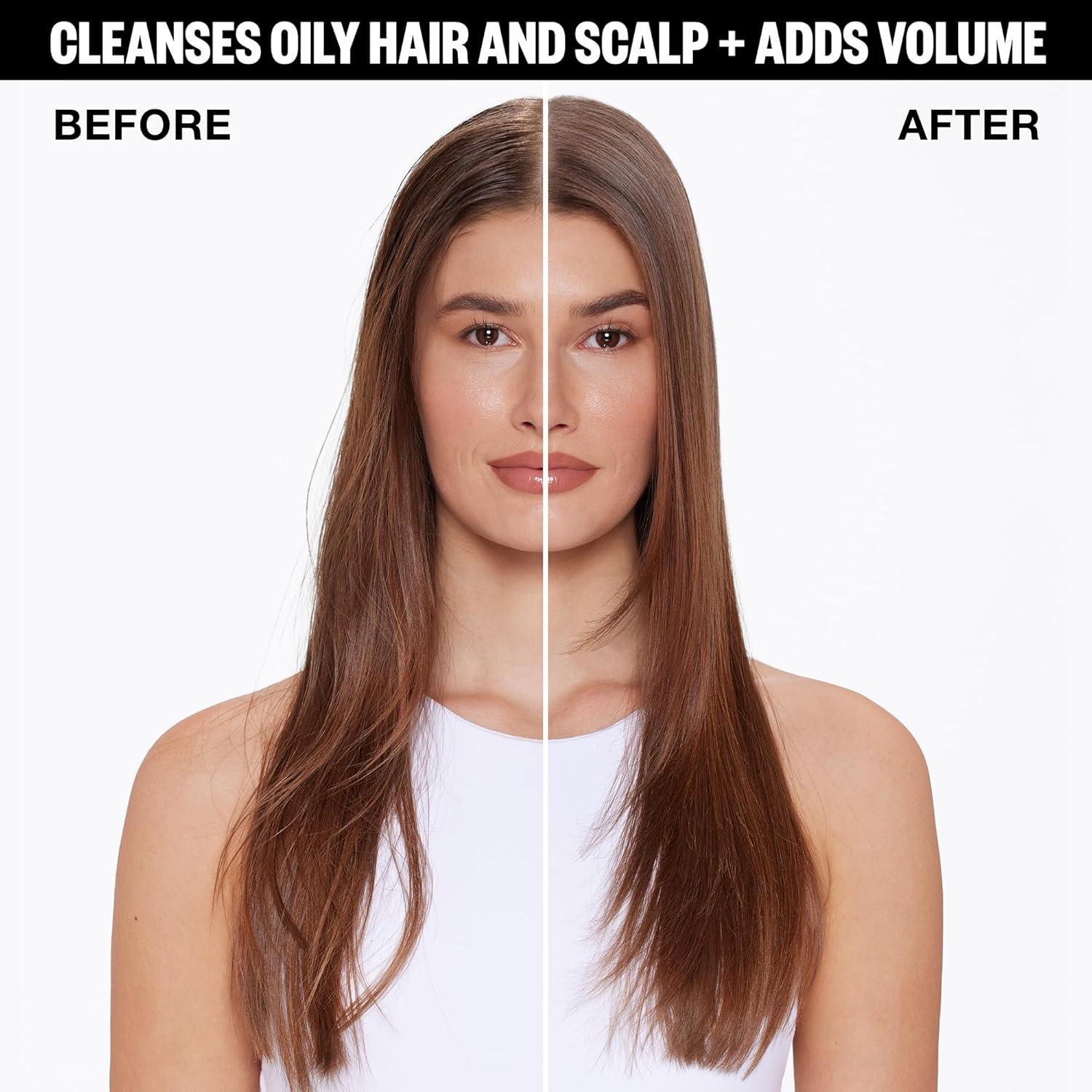 imageIGK FIRST CLASS Charcoal Detox Dry Shampoo for Oily Hair Balances Oil Soothes Scalp Volumizes Vegan Cruelty Free63 Fl Oz Pack of 1