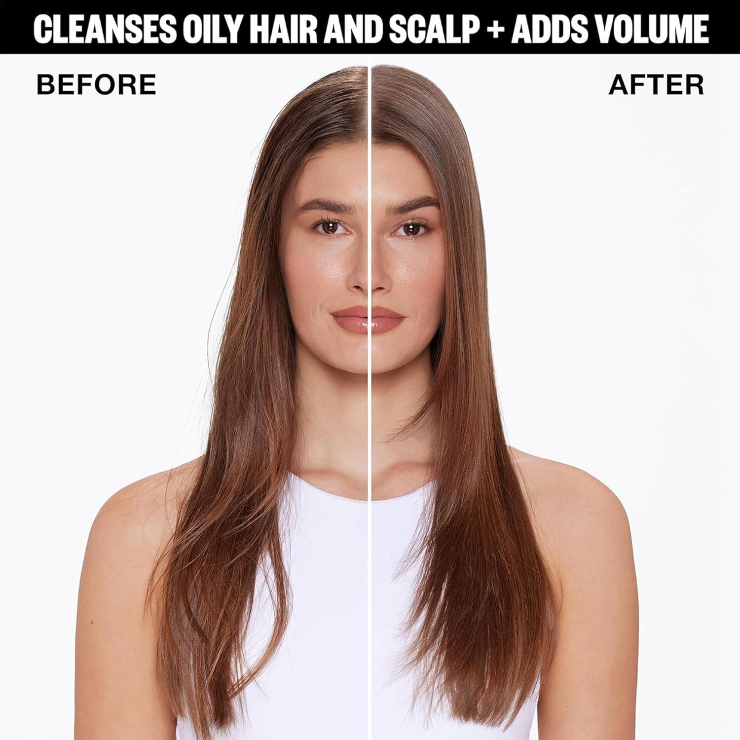 imageIGK FIRST CLASS Charcoal Detox Dry Shampoo for Oily Hair Balances Oil Soothes Scalp Volumizes Vegan Cruelty Free63 Fl Oz Pack of 2